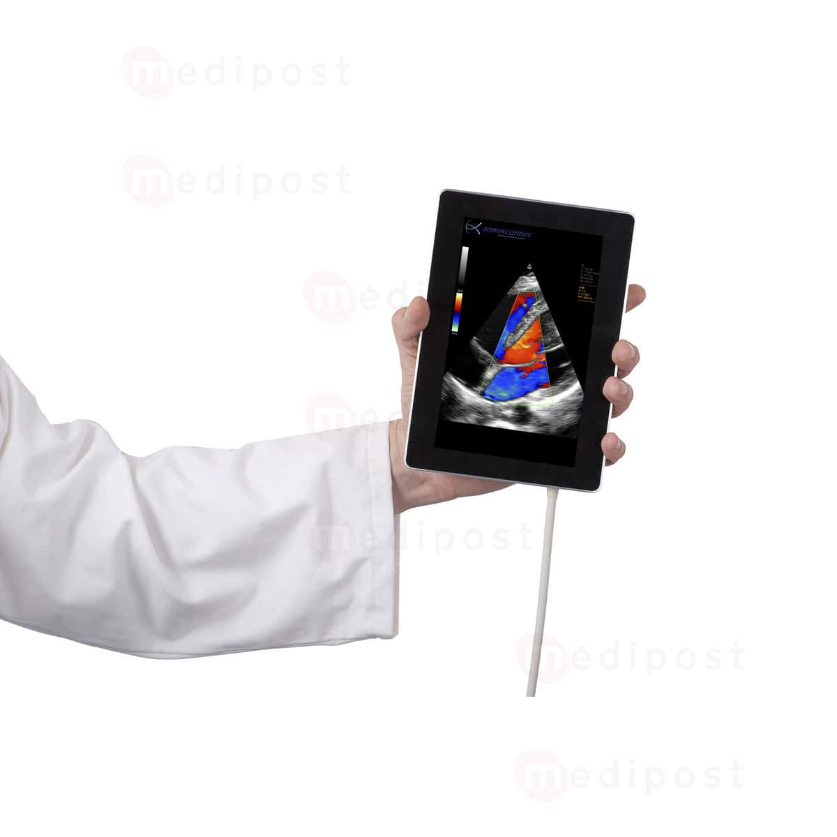 Echographe HD Sonoscanner U Lite M02