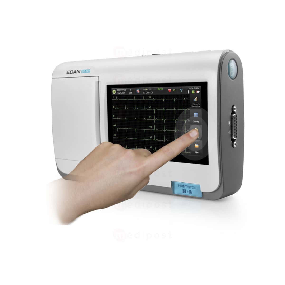 Electrocardiographe Edan SE 301 3 canaux et interpretation M03