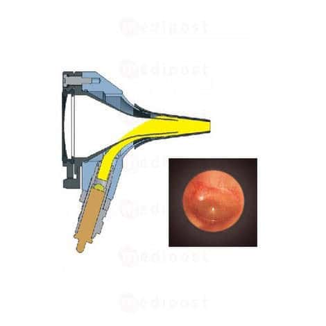  A 153 BETA400ET200 M04