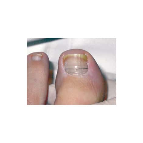 Languette Bacquart M04