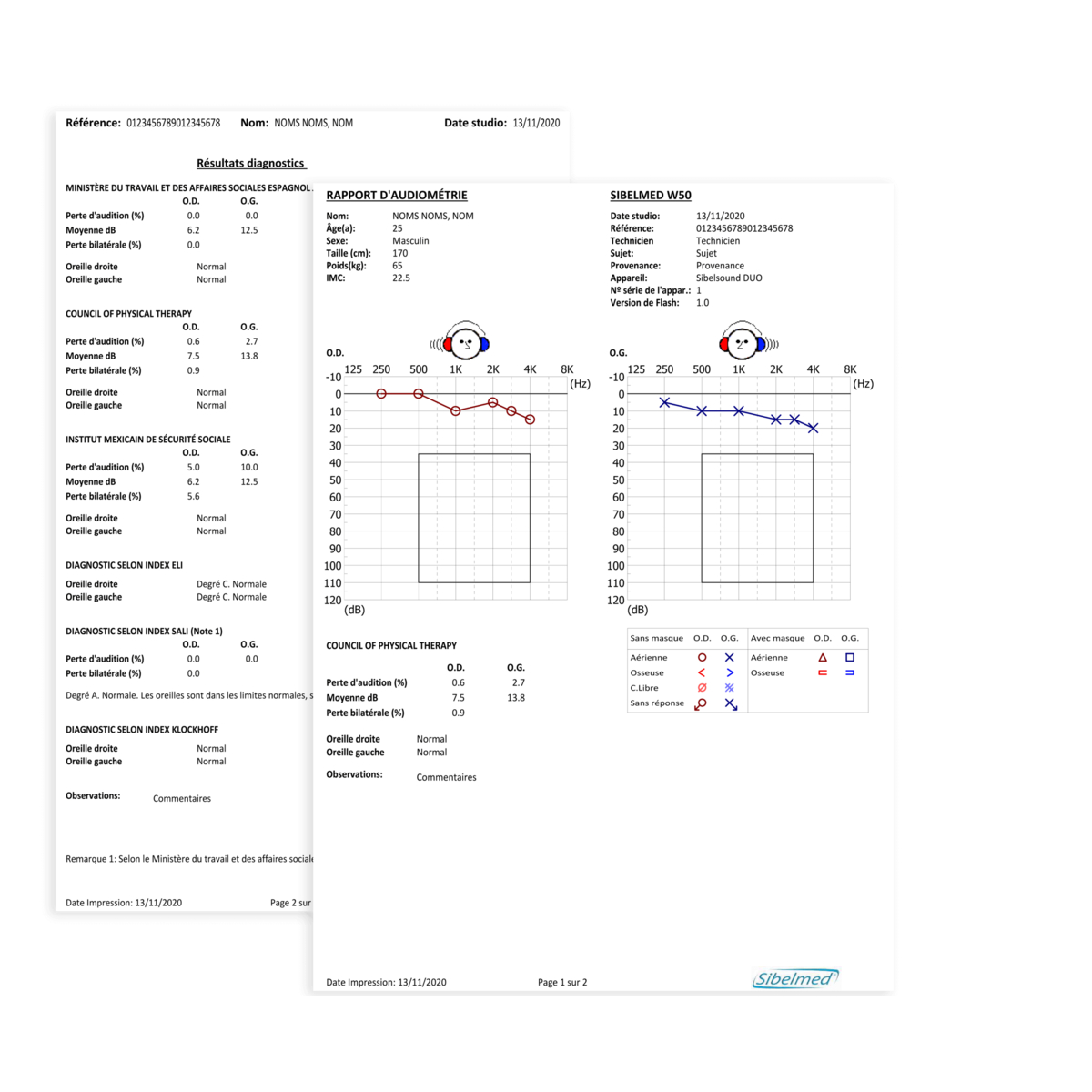 02303 Logiciel SIBELMED W50 pour Audiomètre Sibelsound M02