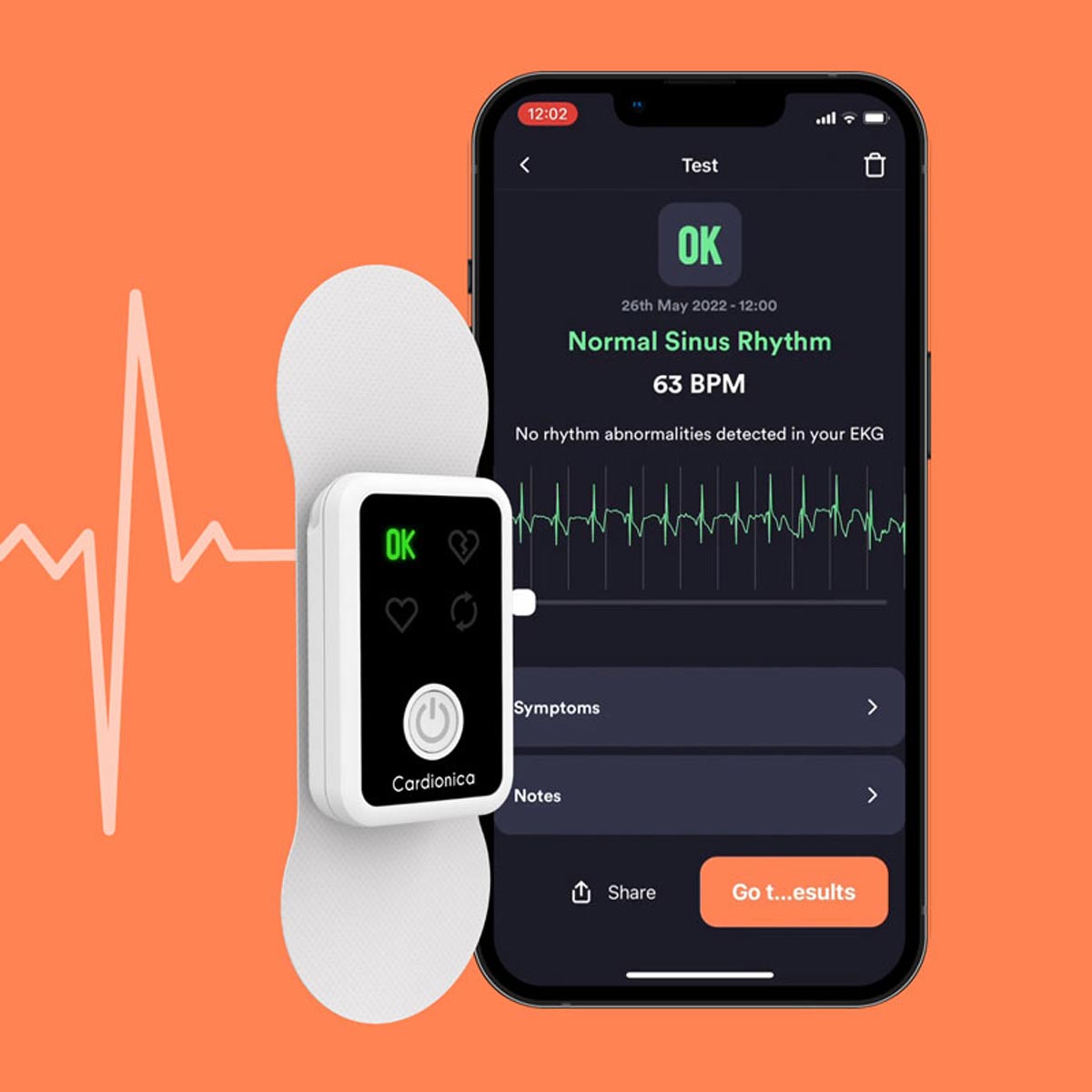 91200000 Moniteur ECG portable 1 dérivation Cardionica M03