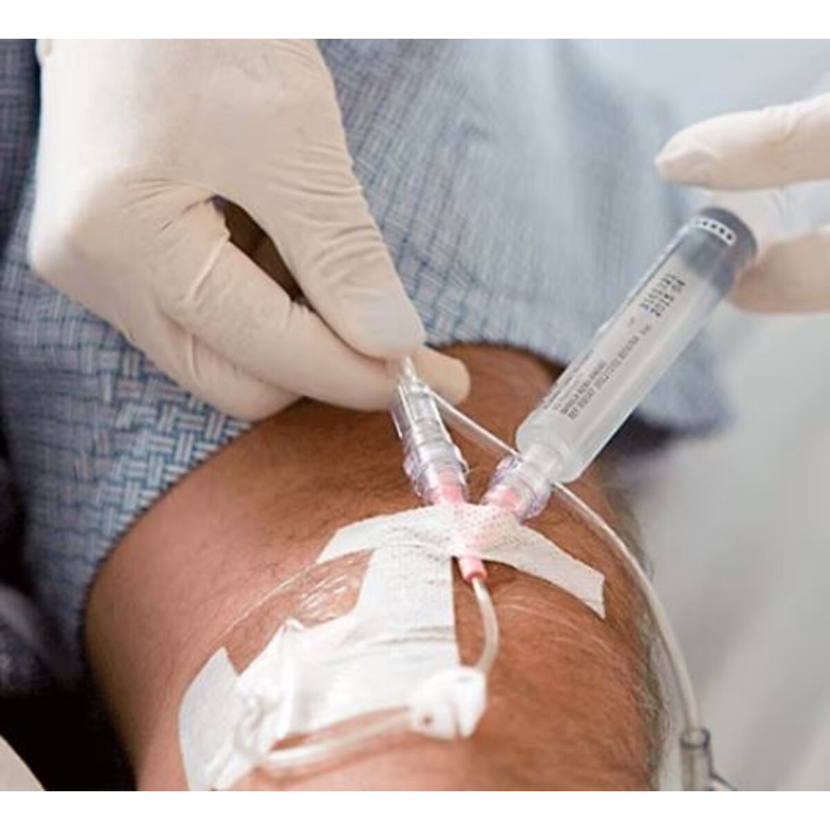 38353X Cathéter IV Nexiva M02