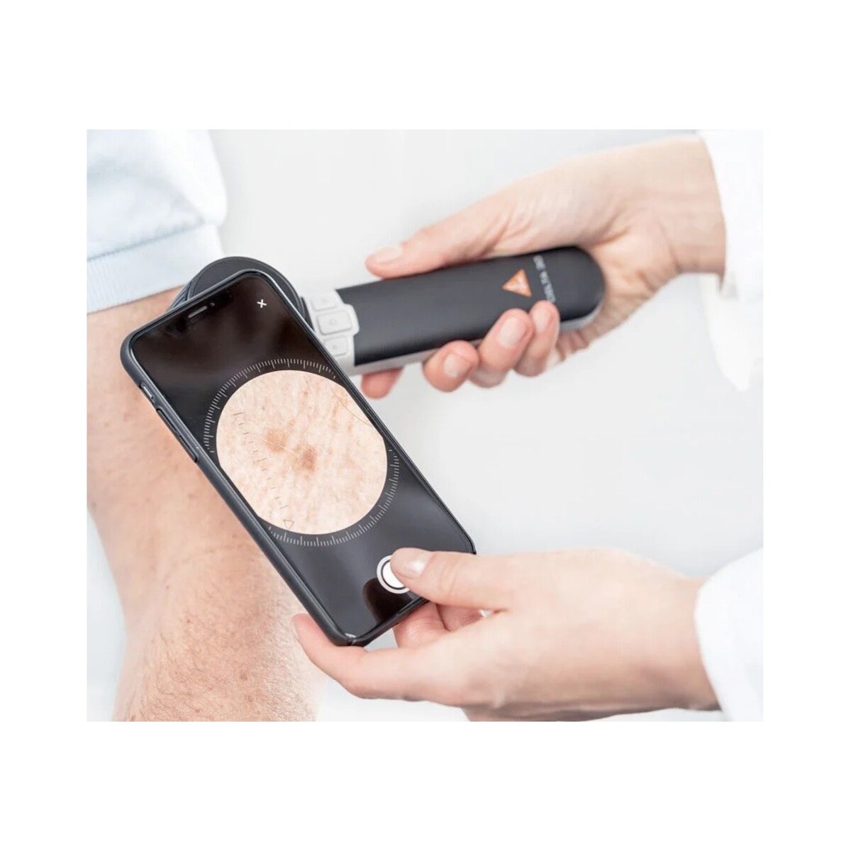 Adaptateur universel Delta Heine smartphone M04