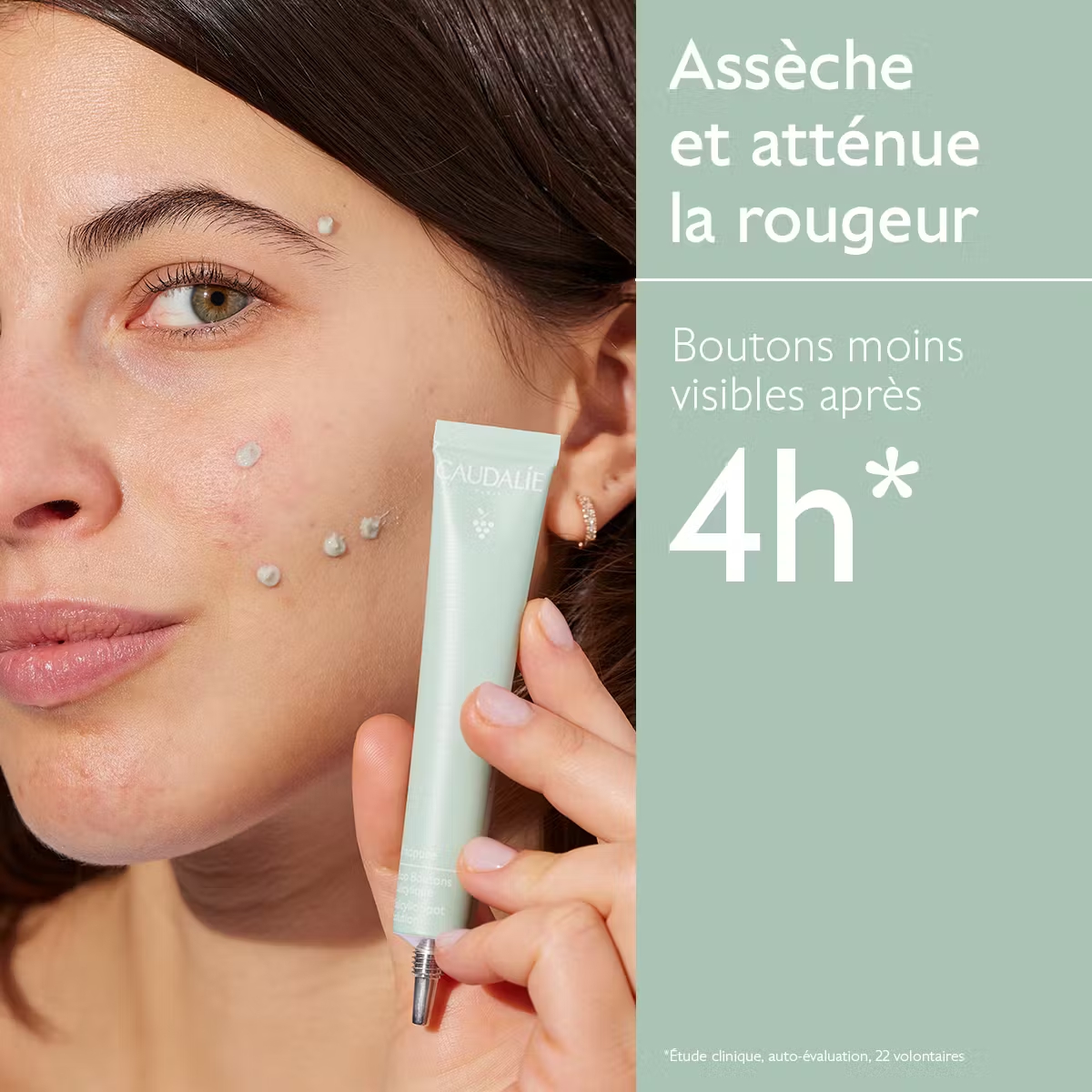 CAUDALIE VINOPURE STOP BOUTONS SALICYLIQUE 15ML M04