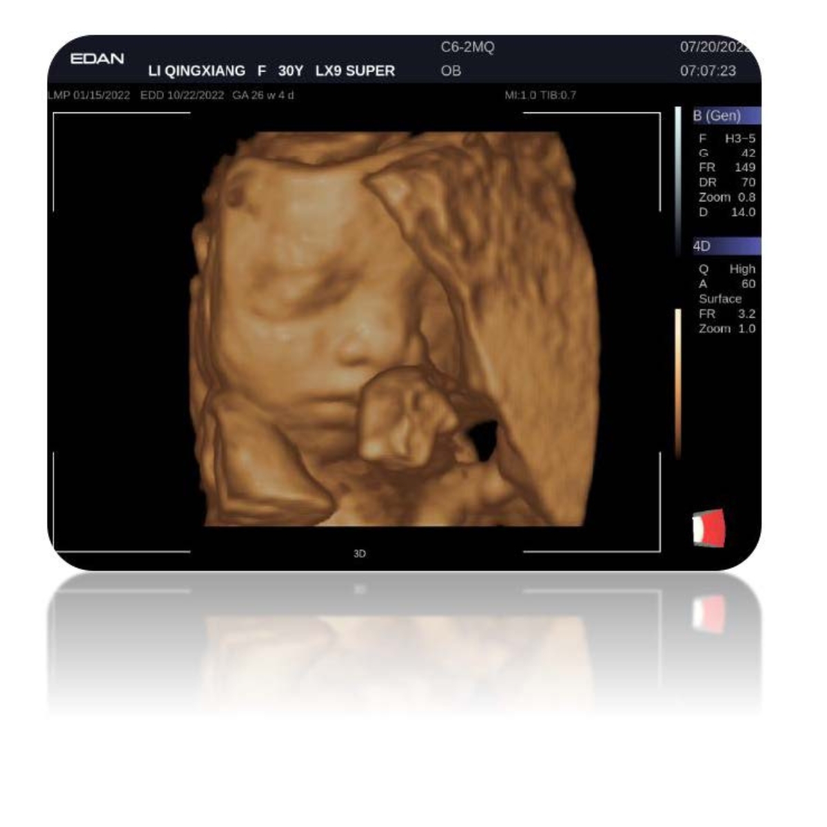 Echographe Edan Acclarix LX9 sans sonde M04