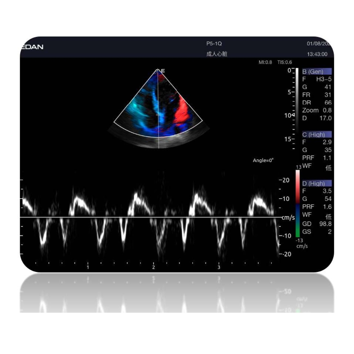 Echographe Edan Acclarix LX9 sans sonde M05