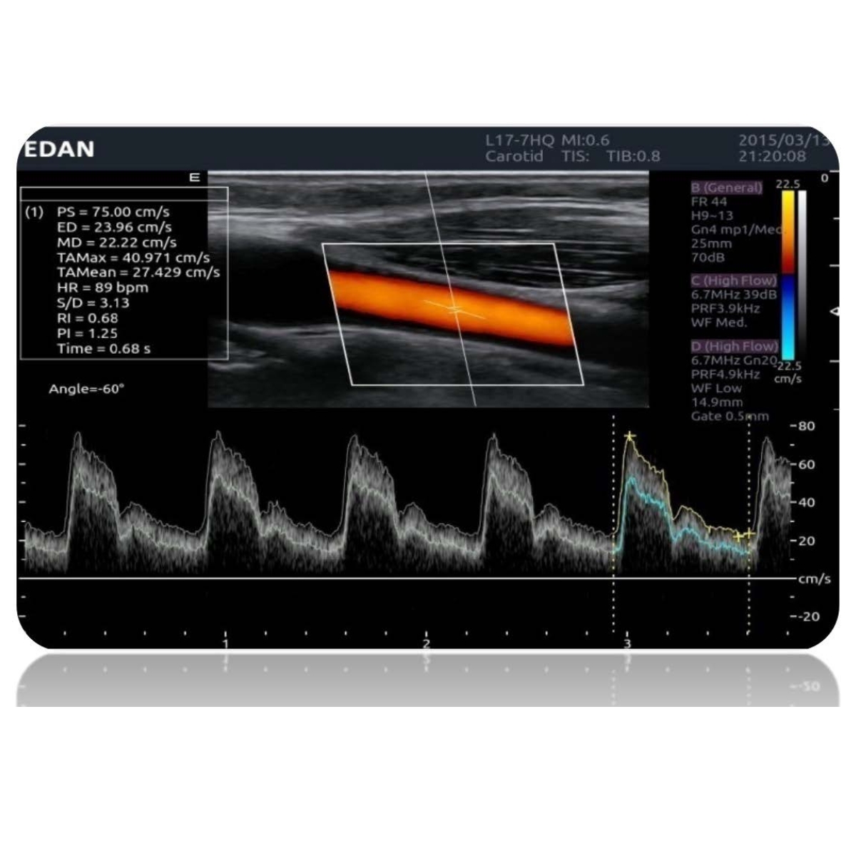Echographe Edan Acclarix LX9 sans sonde M08