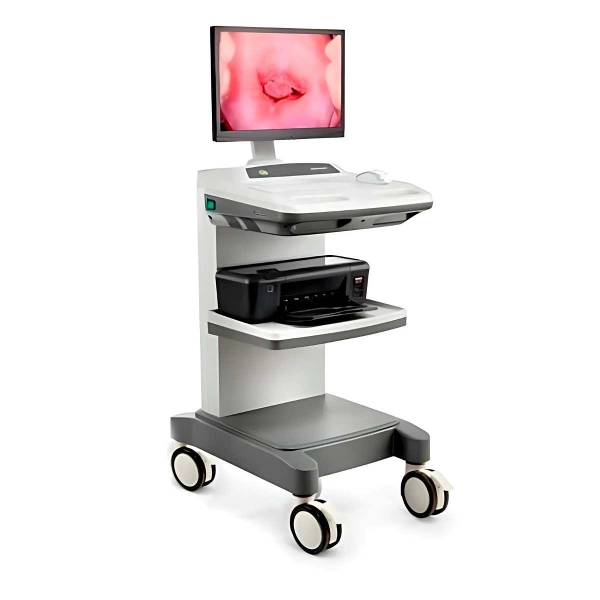 colposcope edan c6 M04