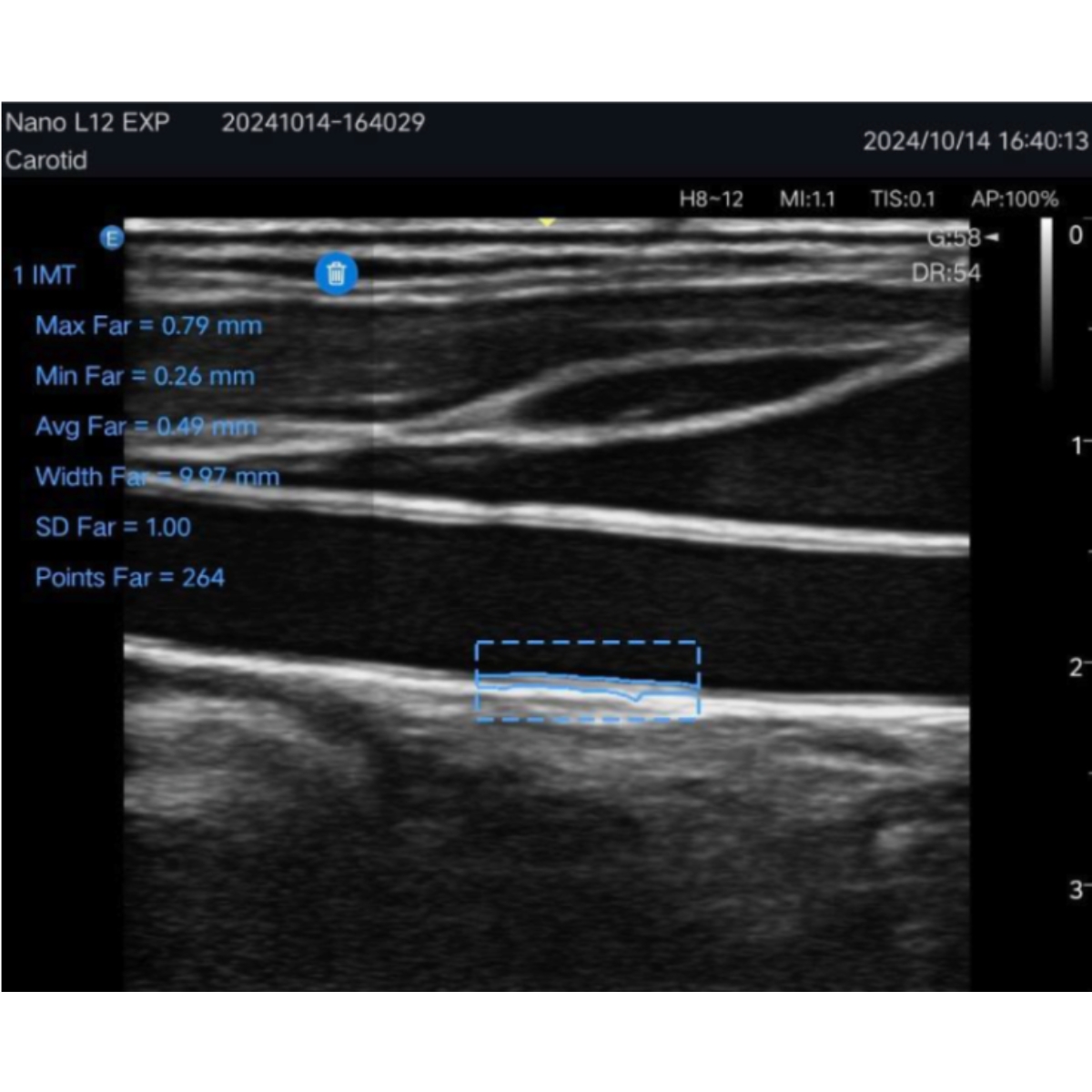 Echographe ultra-portable EDAN Nano L12 EXP M03