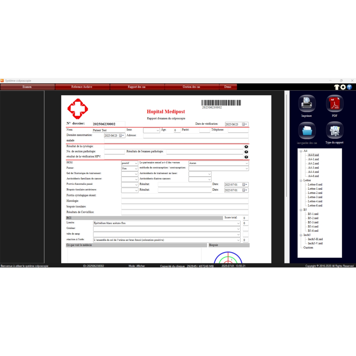 Carte de capture HDMI 4K et Logiciel de colposcopie professionnel M03