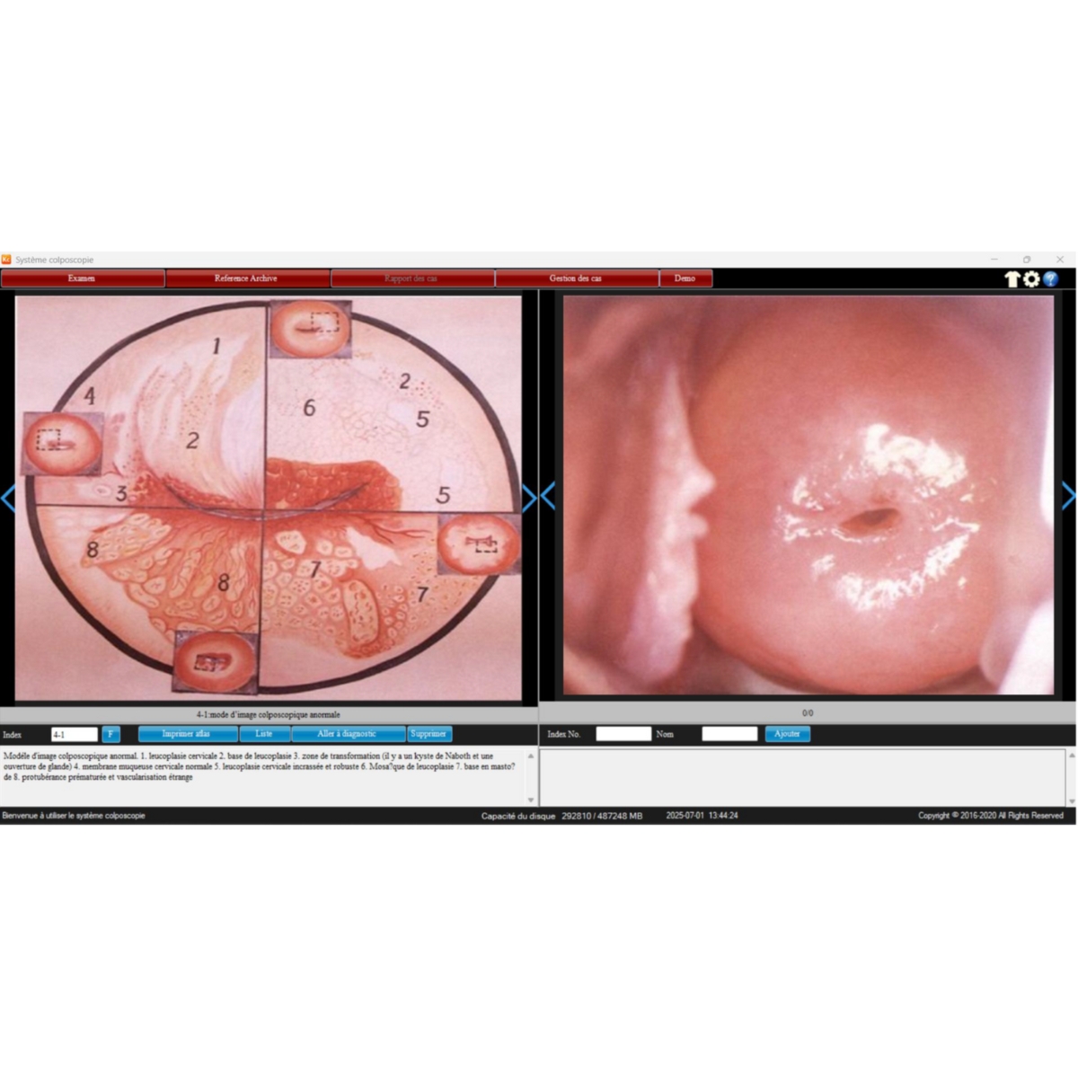 Carte de capture HDMI 4K et Logiciel de colposcopie professionnel M04