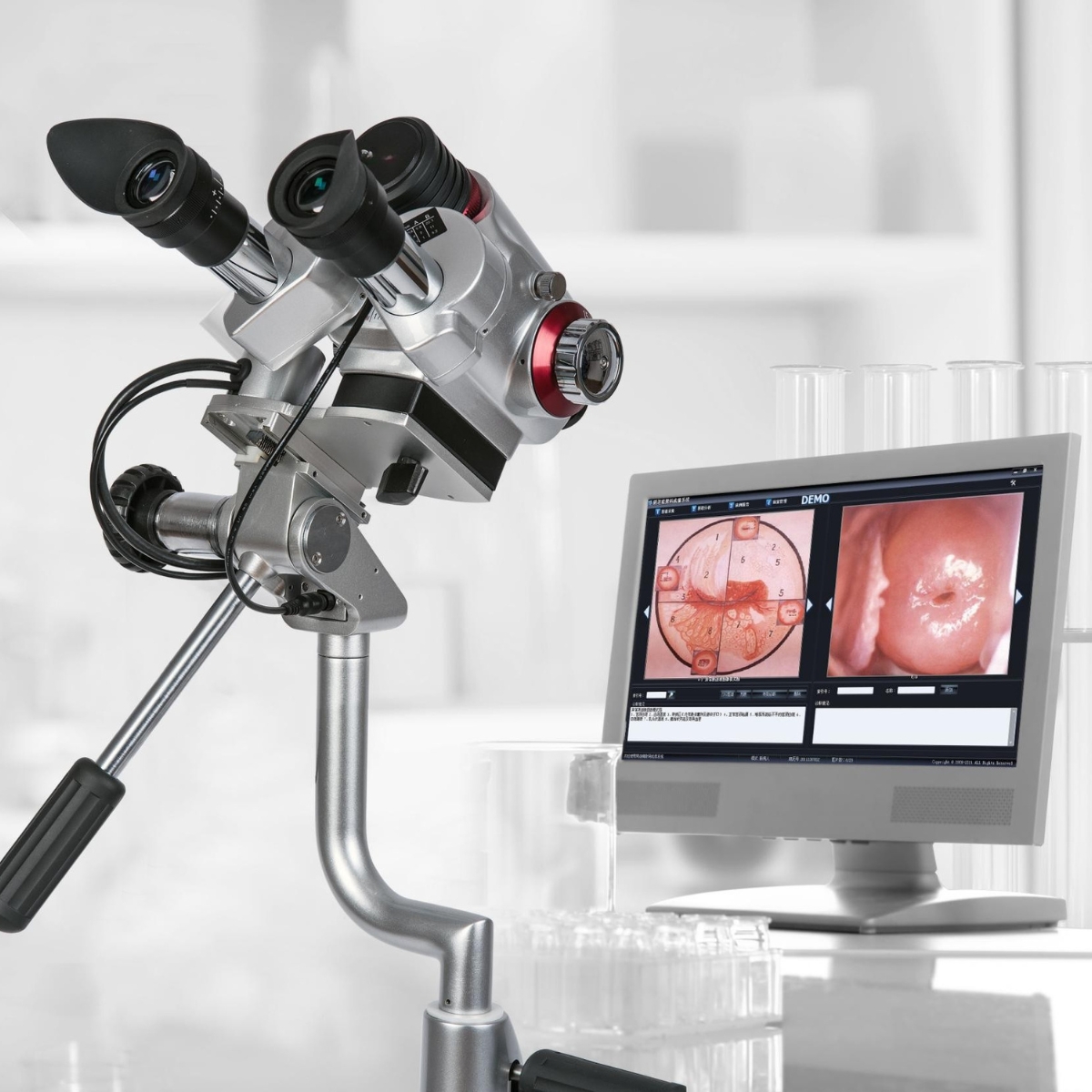 Carte de capture HDMI 4K et Logiciel de colposcopie professionnel M02