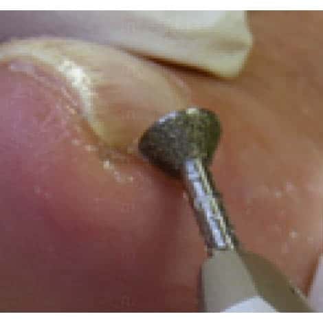 Fraise diamant cone diametre6 5mm side grip grain fin M02