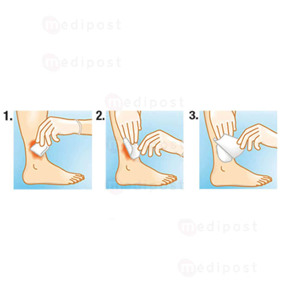 Suprasorb A alginate 10x10cm M04