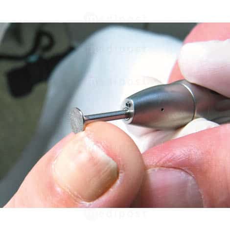 Fraise diamant - disque Ø 6,5mm - top grip grain fin