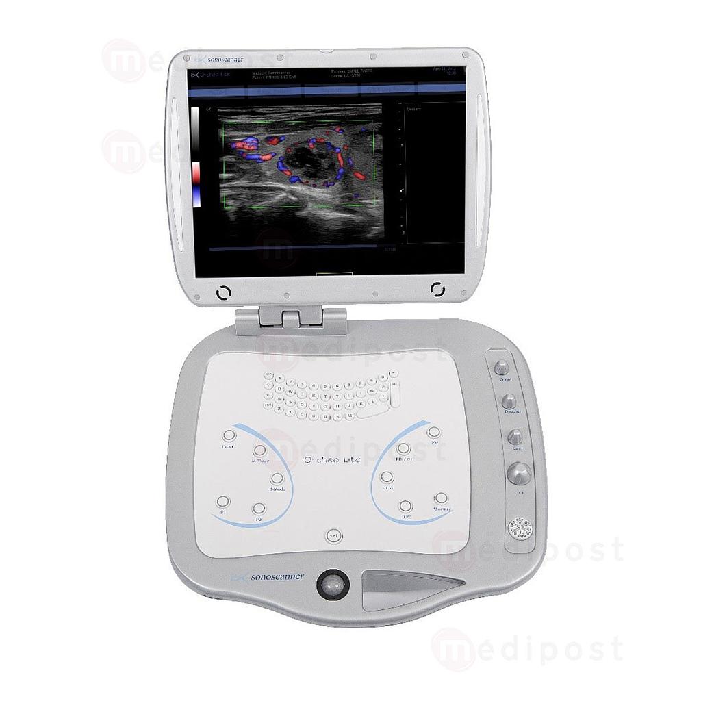 Sonoscanner Orcheo Lite HD ultrageluidscanner
