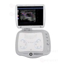 Sonoscanner Orcheo Lite HD ultrageluidscanner