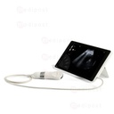 T-Lite échographe portable HD écran 10’’