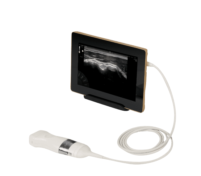 Sonoscanner U-Lite HD ultrageluidscanner
