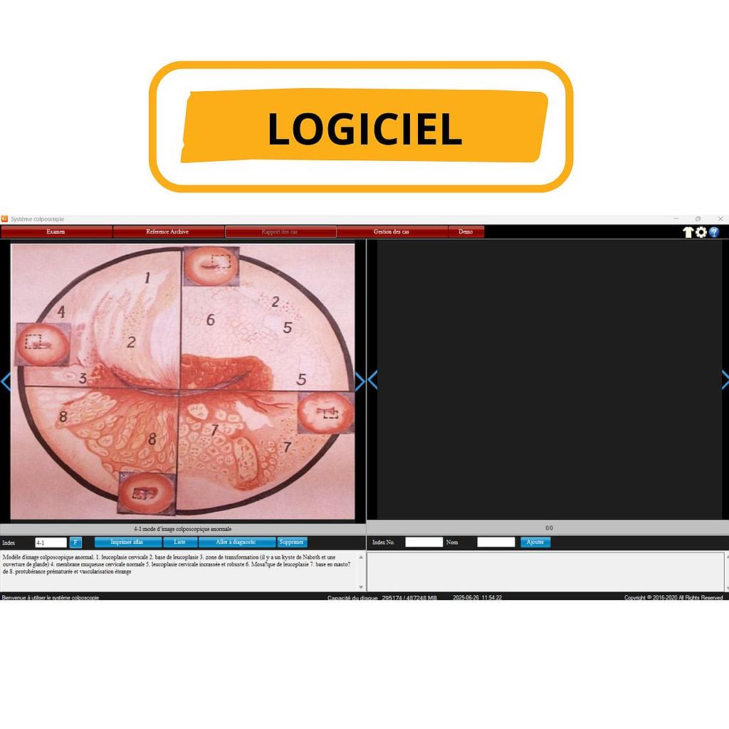 HDMI Capture card & Professional Colposcopy Software for AC-2311