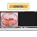 HDMI-opnamekaart & professionele colposcopiesoftware voor DA HD-videocolposcoop